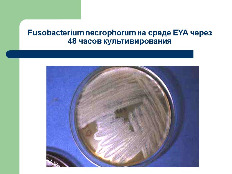Fusobacterium necrophorum на среде EYA через 48 часов культивирования